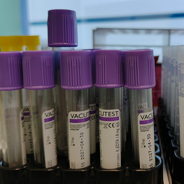 Ορμονολογικές Εξετάσεις